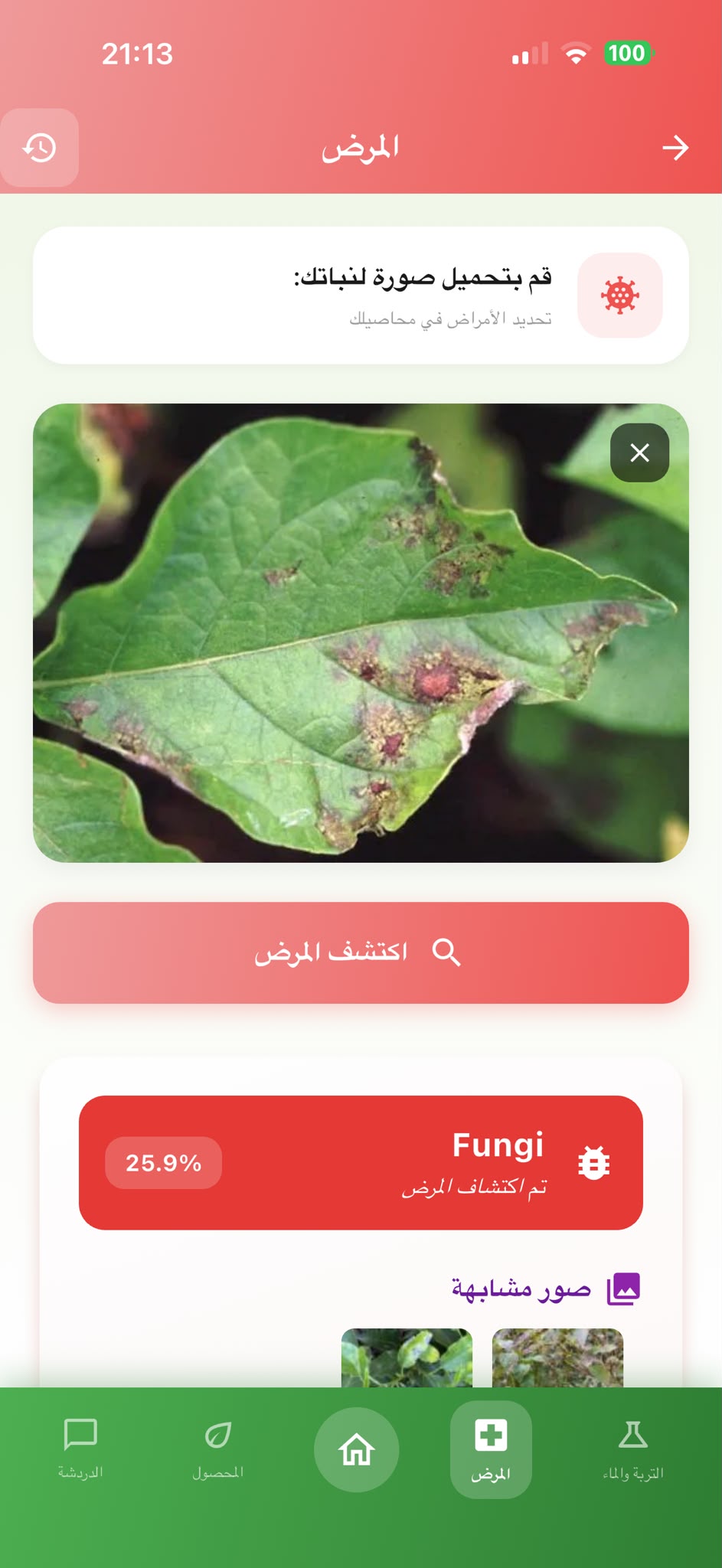 شاشة اكتشاف أمراض المحاصيل في AgroAdvisor وتوضح مسار تحليل صحة النبات بمساعدة الذكاء الاصطناعي